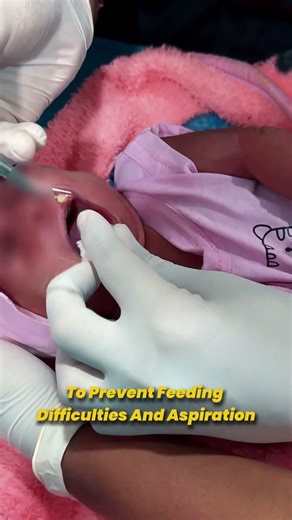 Baby Born With Teeth? Neonatal Teeth Explained by Dentist