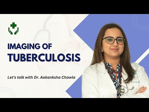 Imaging of Tuberculosis | Chest Radiology Explained | Dr. Aakanksha Chawla