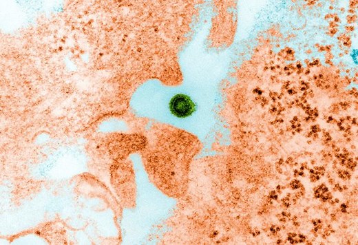 Dengue · Inserm, La science pour la santé