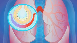 患上急性肺水肿的典型症状 大多数人在发作前都有这些诱因