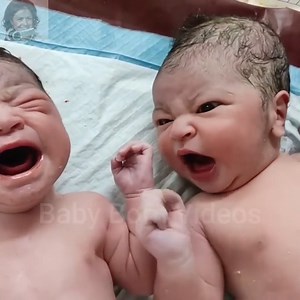 Twins Cute newborn babies with unique expressions immediately after birth. #twins #newborn #newbornbaby #babycrying | New Born Baby