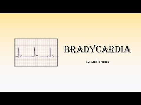 Bradycardia - causes, mechanism and pathophysiology, sign value