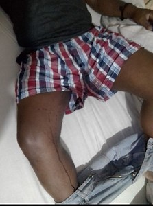 WATCH: Man who was dragged by his private parts speaks out