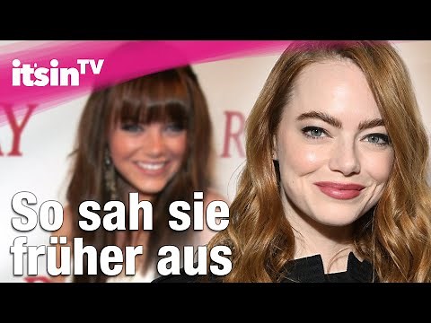 Emma Stone früher vs heute: Ihre heftige Verwandlung! | It's in TV
