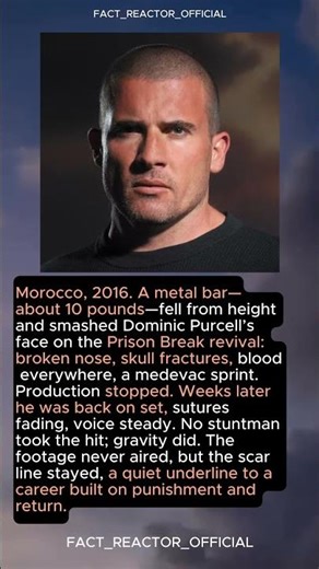 Dominic Purcell — skull fractured on Prison Break #OnSetAccident #Recovery