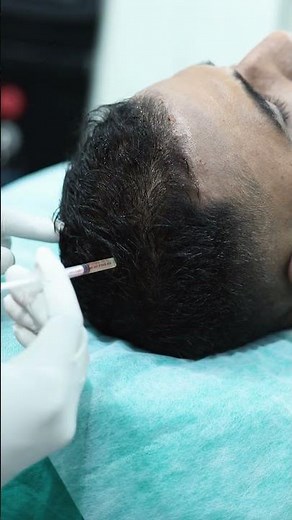 Advanced PRP Hair Treatment for Stronger Hair | Skinaa Clinic #haircare #hairlosstreatment