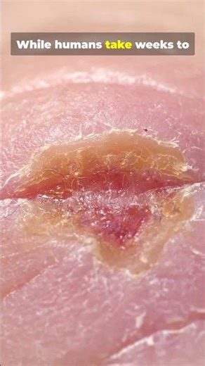 Starfish Have AMAZING Regrowth Powers Can They Really Regrow Their Arms?