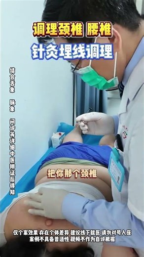 #Cervical vertebrae#Thread embedding conditioning