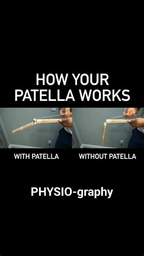 Function of patella | PHYSIO-graphy