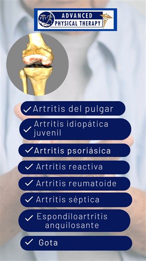 ¿Sabías que existen diferentes tipos de artritis? 🤔🦵 Conocerlas te ayuda a identificar tus síntomas y buscar el tratamiento adecuado a tiempo. En Advanced Physical Therapy estamos aquí para orientarte y ayudarte a sentirte mejor. 💙 📲Llámanos para agendar tu espacio o asesoría: (787) 219-7866 / (787) 471-7766 / (787)234-5496 (Tel. Móvil y mensajería privada de WhatsApp) 📍 Estamos ubicados en calle Jose I. Quinton #94, Coamo PR. 00769. #AdvancedPhysicalTherapy #Terapia #TecnologíaLaser #Puert