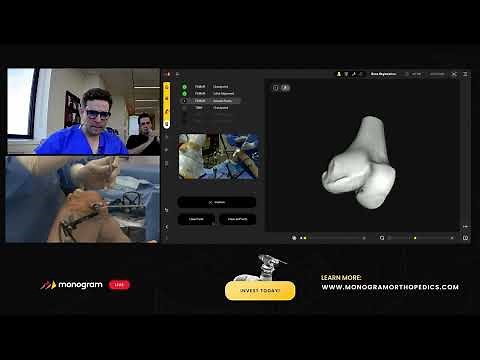 Monogram Makes Orthopedic History! Fully Remote Robotic Surgical Demo