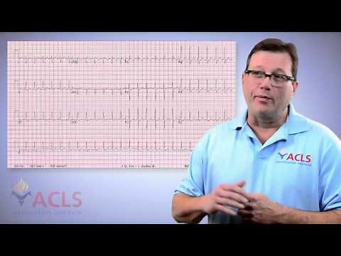 ACLS Mailbox - Adenosine for Ventricular Tachycardia by ACLS Certification Institute
