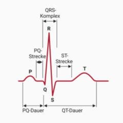 Elektrokardiogramm - DocCheck Flexikon