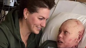 Strength of Ottawa’s “Butterfly Boy” felt around world