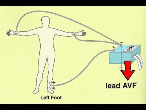 🔴 THE 12 ECG LEADS EXPLAINED VERY CLEARLY - DR ASTUCE