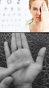 621K views · 8.4K reactions | Eyesight Weak Problem | Healing Therapy | Facebook