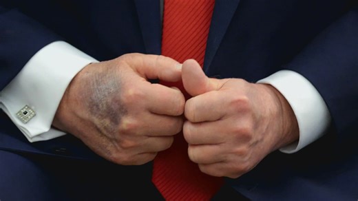 Trump reveals new details about his health in new interview