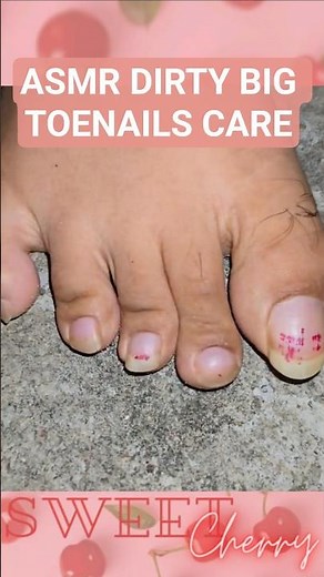 ASMR DIRTY FEET SOLES & TOENAILS CLEANING | HAIRY LEGS #asmr #satisfyingasmr #triggers #feet