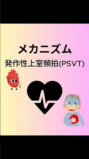 PSVTとは？突然ドキドキする不整脈のしくみ
