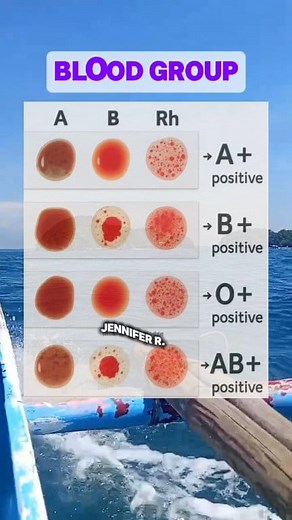 Positive or Negative? Decode Your Blood Group Combo! Do you know your Rh (positive/negative) status? 👉 Follow for more quick health hacks! #BloodGroup #RhFactor #HealthTips #FollowForMore | Jennifer Racho