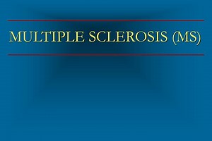 MULTIPLE SCLEROSIS (MS) - SlideServe