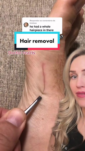 Understanding Hair Splinters: Risks for Animal Owners