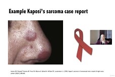 The Methods: Case Reports