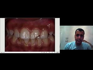 tips and tricks series " shade selection "