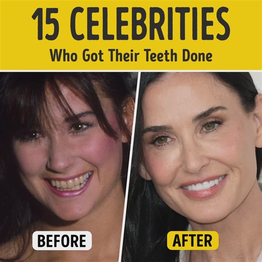 481K views · 1.6K reactions | 15 Celebrities Who Got Their Teeth Done | You're Gorgeous | Facebook