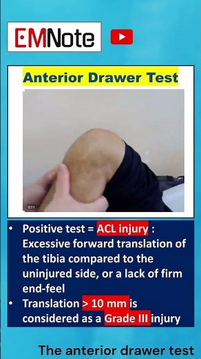 Anterior Drawer Test Knee ACL Injury #doctor #nursing