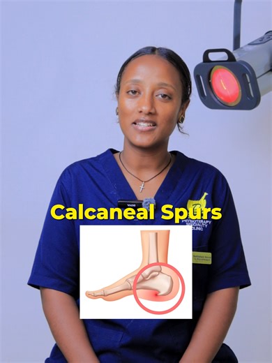 Calcaneal Spurs #physiotherapy#calcanealspur #heelpain #physiotherapytreament