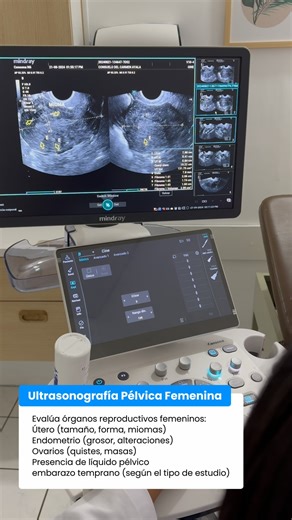 ✨ ¿Sabes qué ves en cada ultrasonografía? Este estudio es una de las herramientas más valiosas para evaluar órganos, tejidos y estructuras internas de manera segura y no invasiva. En el siguiente video te contamos qué información revela una ultrasonografía, cómo se interpreta y por qué es tan importante para un diagnóstico preciso y oportuno.  ¡Dale play y aprende más sobre este estudio que cuida de tu salud desde adentro! | Hospital Lourdes | Facebook