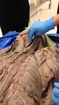 Semispinalis and Multifidi Muscles