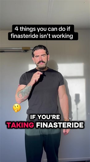 Alternative Solutions for Finasteride Treatment