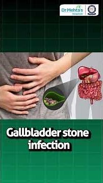 Gallstones Treatment Explained – When Is Surgery Really Needed?