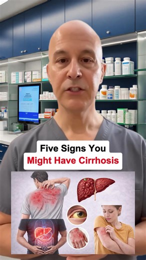Five Signs You Might Have Cirrhosis Explained