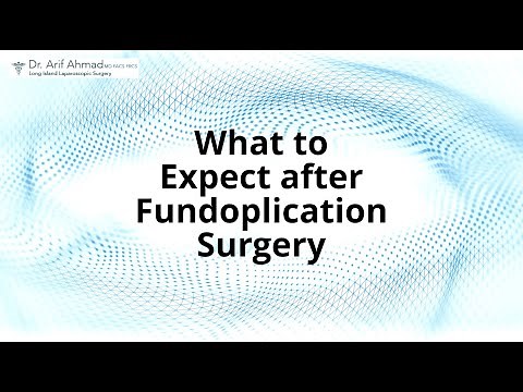 What to Expect after Fundoplication Surgery