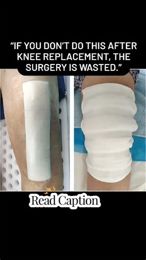 Abhishek Motarge on Instagram: "🔴 WHY REHABILITATION IS CRITICAL (FOR PATIENTS) Knee replacement surgery replaces the joint. Rehabilitation trains the body to use it. Without proper rehab: Knee becomes stiff Muscles become weak Walking remains painful Confidence never returns 👉 Rehab decides how well you walk, sit, climb stairs, and live. 🎯 MAIN GOALS OF KNEE REPLACEMENT REHAB Control pain & swelling Restore knee bending & straightening Strengthen thigh & hip muscles Improve balance & walking