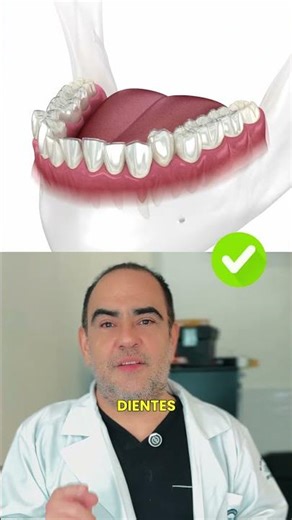 ¿Férulas o alineadores? Conoce la diferencia.