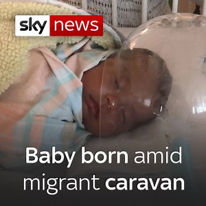 64K views · 172 reactions | Juana is only 51 days old. Her mother...