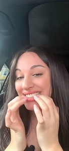 ASMR TEETH SCRATCHING & TAPPING⭐️
