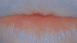 Captivating Lip and Teeth Close-Up Video