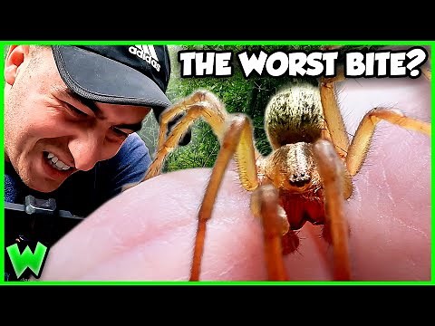 What Happens if a Hobo Spider BITES You?