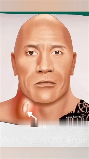 ASMR_Aijul | ASMR Cheek Ring 💍 Piercing Cleaning Treatment Animation #asmr #shorts #viral #reel #satisfying #animation #trending | Instagram