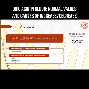 Uric acid in blood: normal values and causes of increase/decrease #uricacid #bloodtest #nephrology | About health and science in simple words