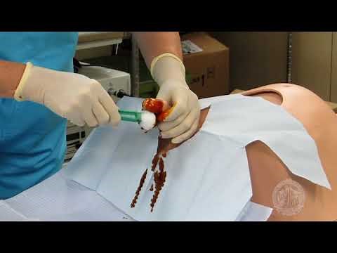 Foley Bladder Catheterization MALE [ASE]