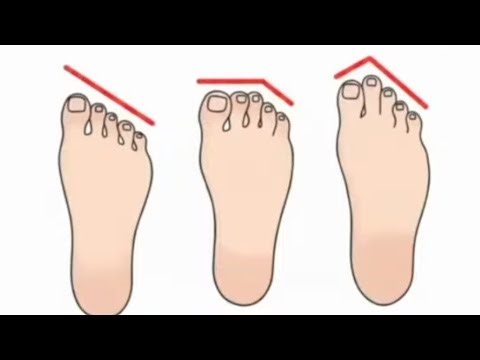 𝙒𝙝𝙖𝙩 𝙮𝙤𝙪𝙧 𝙎𝙩𝙖𝙩𝙪𝙨? 😎