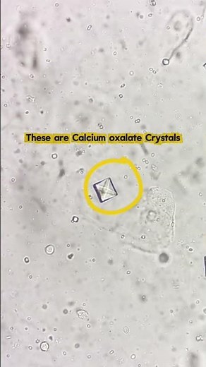 Calcium Oxalate crystals