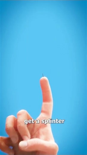 What Happens if You DON’T Remove a Splinter? 🪵😱 #facts #shortsfeed #dailyfacts #shorts #viral