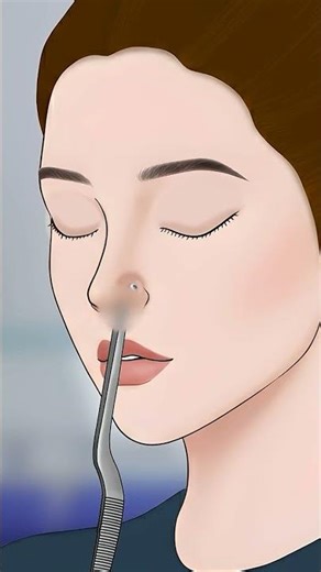 EXTREME Close Up! 🚨 INFECTED Piercing Removal ASMR (Whispering, Gloves, Popping Sounds) #asmr #ai